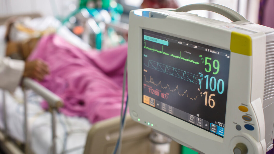 LIVSNØDVENDIG: Respiratorer er mangelvare i en korona-rammet verden. Nå går bilprodusenter som Nissan og McLaren sammen om å lage livsnødvendig utstyr. Foto: Shutterstock LIVSNØDVENDIG: Respiratorer er mangelvare i en korona-rammet verden. Nå går bilprodusenter som Nissan og McLaren sammen om å lage livsnødvendig utstyr. Foto: Shutterstock